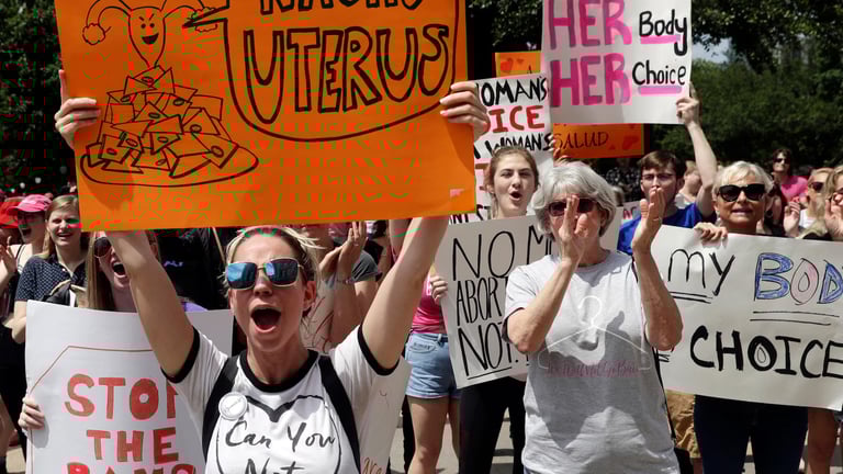 Surge in Tubal Ligations Linked to Stricter State Abortion Laws Post-Dobbs Ruling