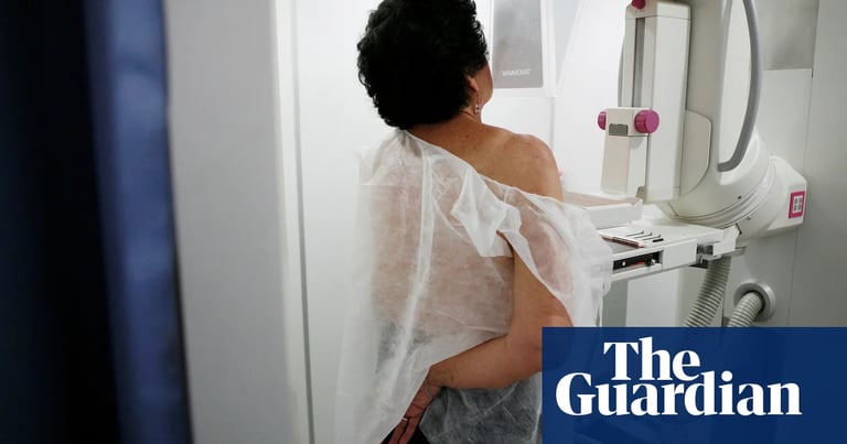 NHS Launches First Breast Cancer Screening Campaign to Boost Participation Amid Decline