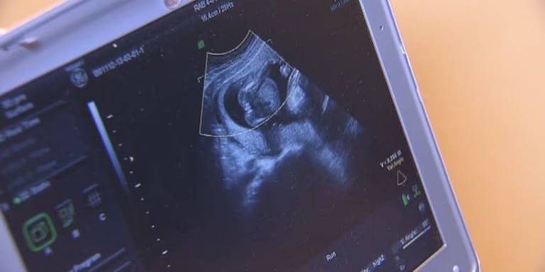 South Carolina Supreme Court Upholds 'Fetal Heartbeat' Abortion Ban, Igniting Fierce Debate