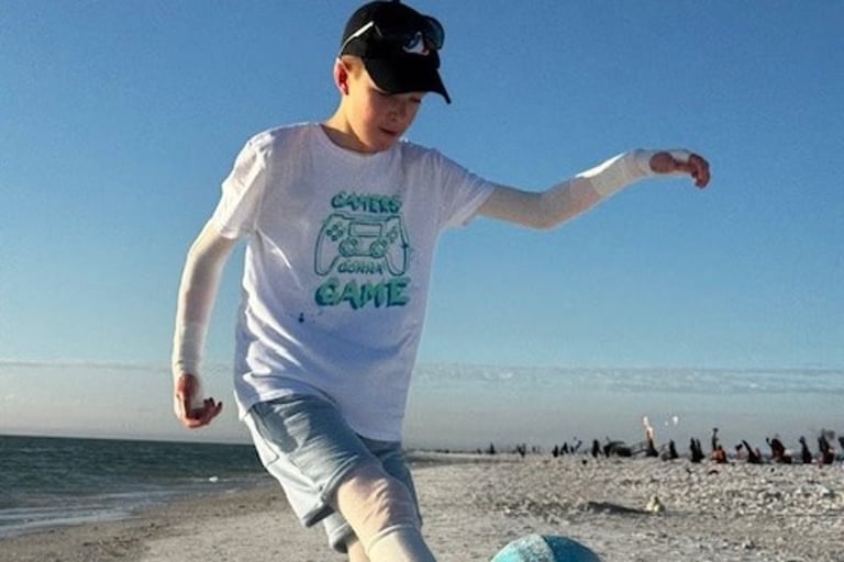 Stem Cell Breakthrough Offers Hope for Children with Rare Skin Disorder