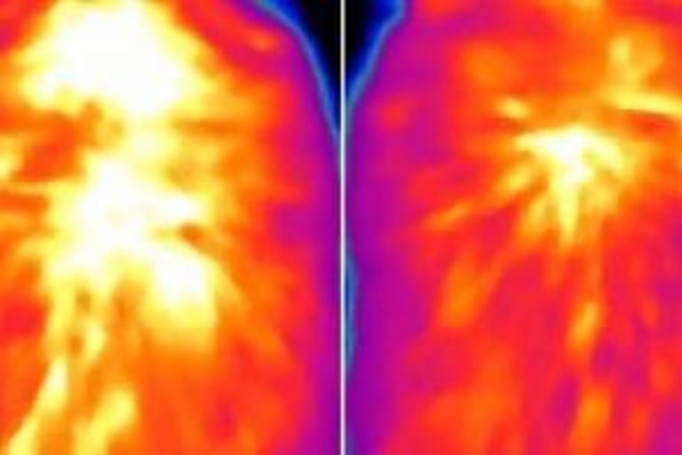 New Enzyme Discovery in Brown Fat Cells Could Revolutionize Obesity and Metabolic Disorder Treatments