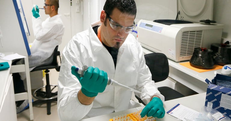 New Study Reveals Microglial Shift Could Combat Alzheimer's by Reducing Brain Inflammation