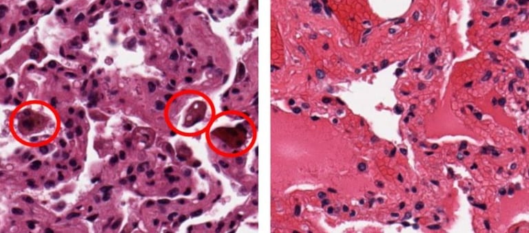 Smoking's Accelerated Aging: DNA Changes Persist Even After Quitting, Study Reveals