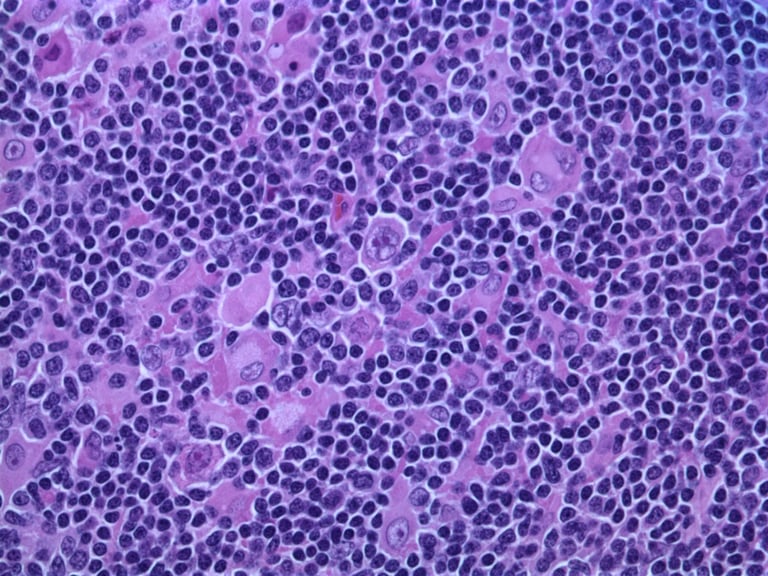 Cancer Cells Hijack Embryonic Programs: New Targets for Treatment and Early Detection