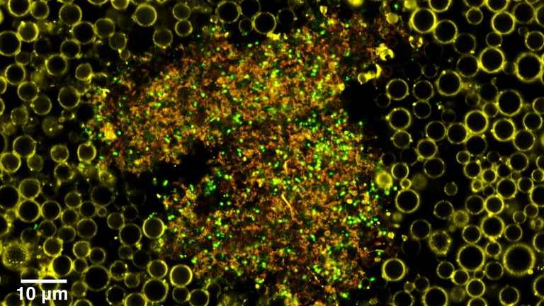Oxford's Ultrasound-Activated Nanoparticles Revolutionize Biofilm Bacterial Treatment