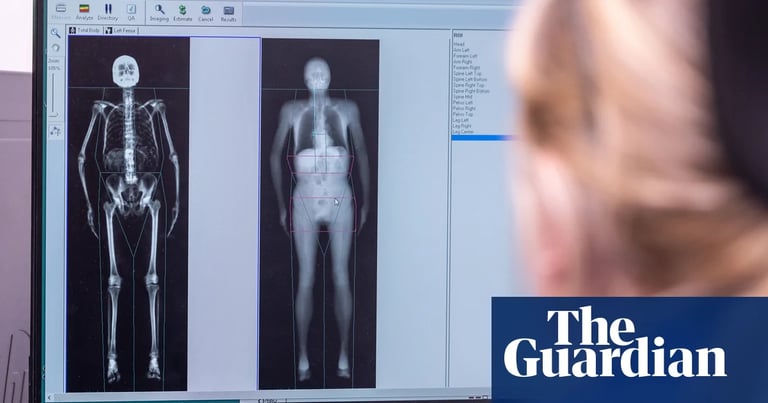 UK Biobank Reaches Milestone: 100,000 Scans Unveil Aging and Health Insights