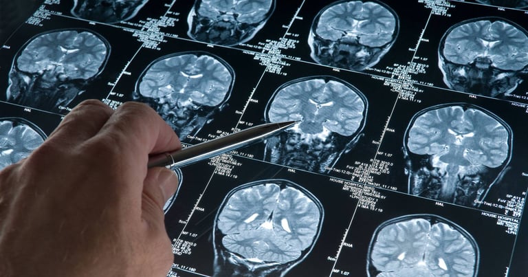 New Study Unveils Potential for Adult Neurogenesis, Sparks Debate on Brain's Regenerative Abilities