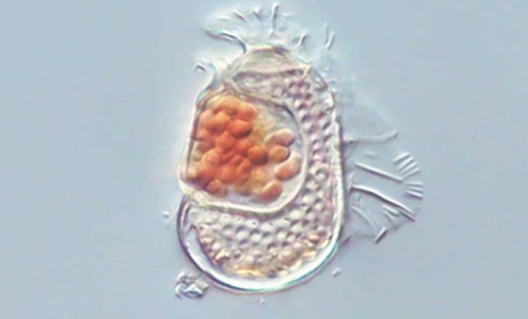 Sukunaarchaeum: The Organism Blurring the Line Between Viruses and Cellular Life
