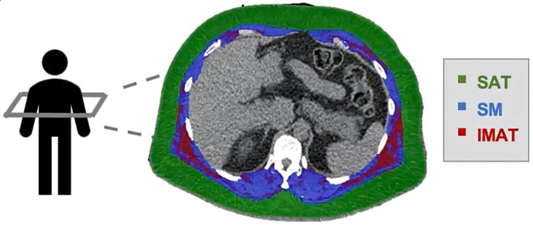 Intermuscular Fat: A Hidden Heart Disease Risk Factor Unveiled by New Study