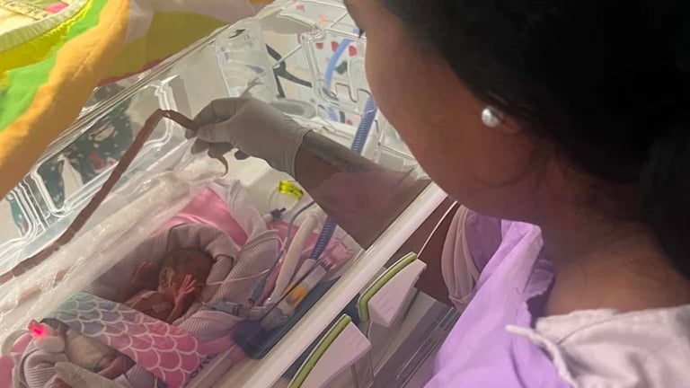 Miracle Baby Born at 21 Weeks Defies Odds, Becomes Australia's Youngest Preterm Survivor