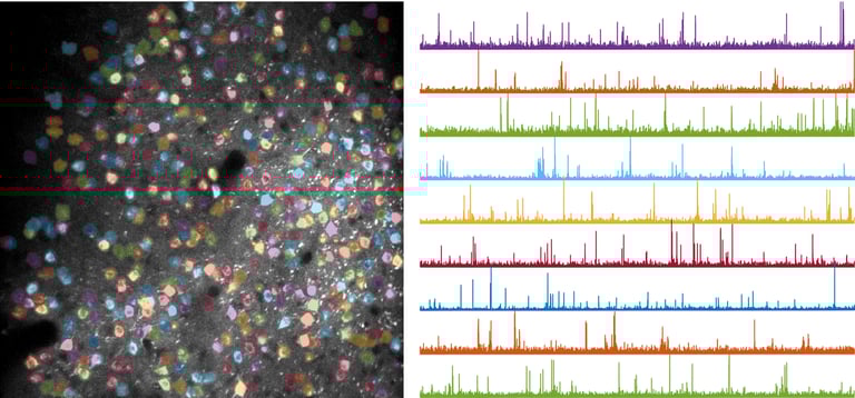 Learning Physically Rewires Brain, Enhancing Neural Communication, UCSD Study Finds