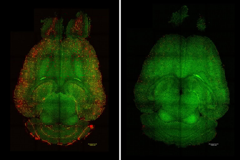 Breakthrough Alzheimer's Treatment Repairs Blood-Brain Barrier, Slashes Amyloid Levels in Mice