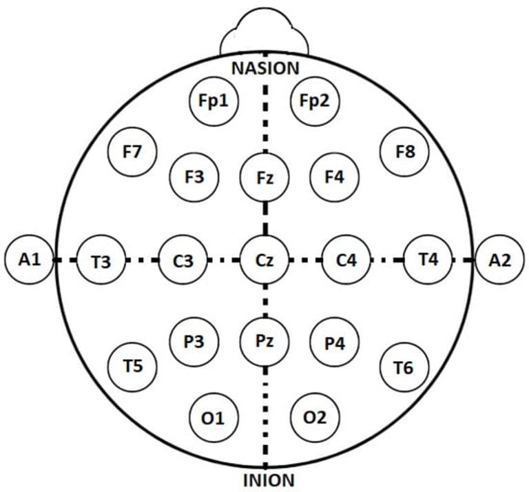 Revolutionary AI Model by UH Team Accurately Classifies Sleep Stages Using Neural Data