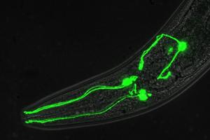 Taking a ‘one in a million’ shot to tackle dopamine-linked brain disorders