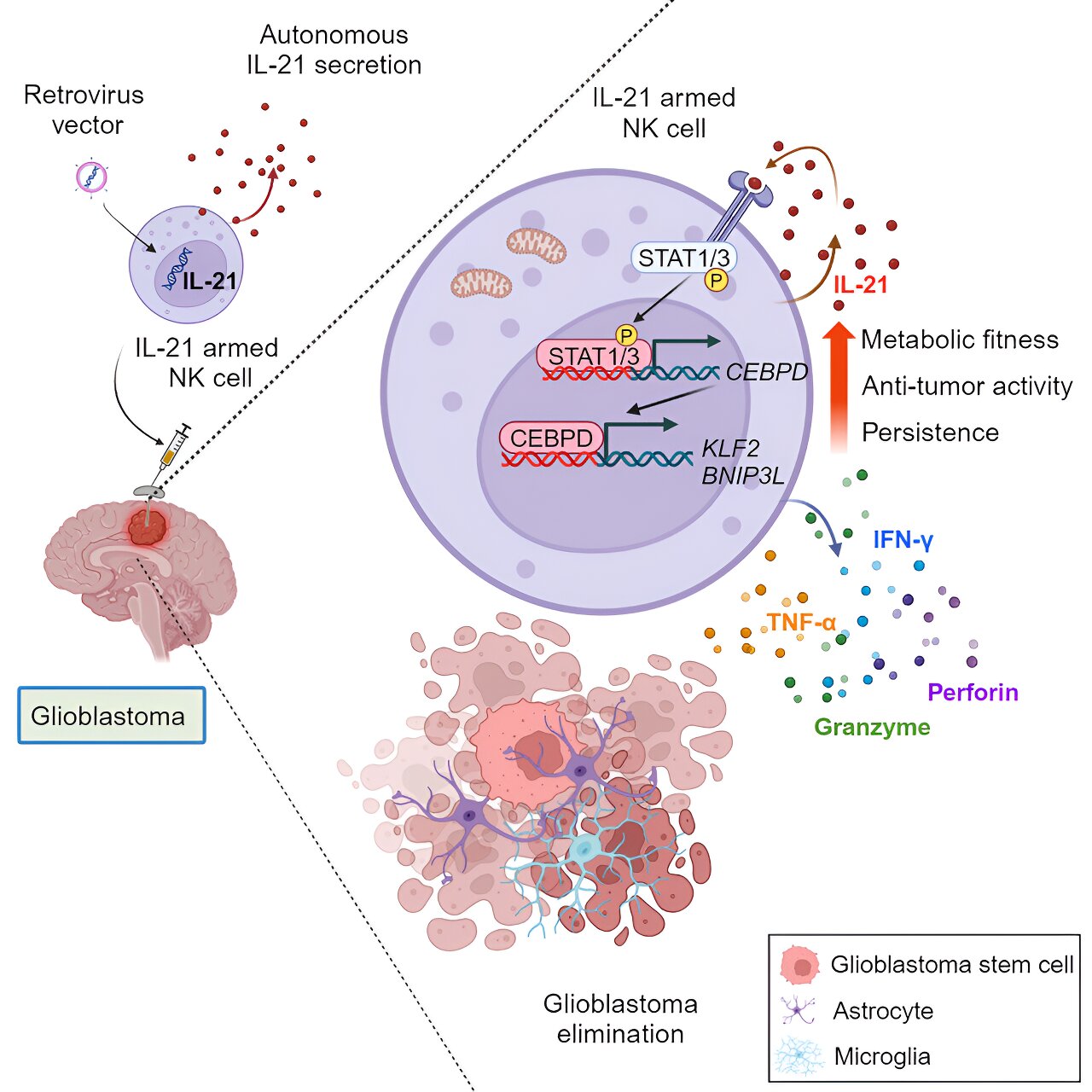 Natural killer cells expressing interleukin-21 show promising antitumor activity in glioblastoma cells