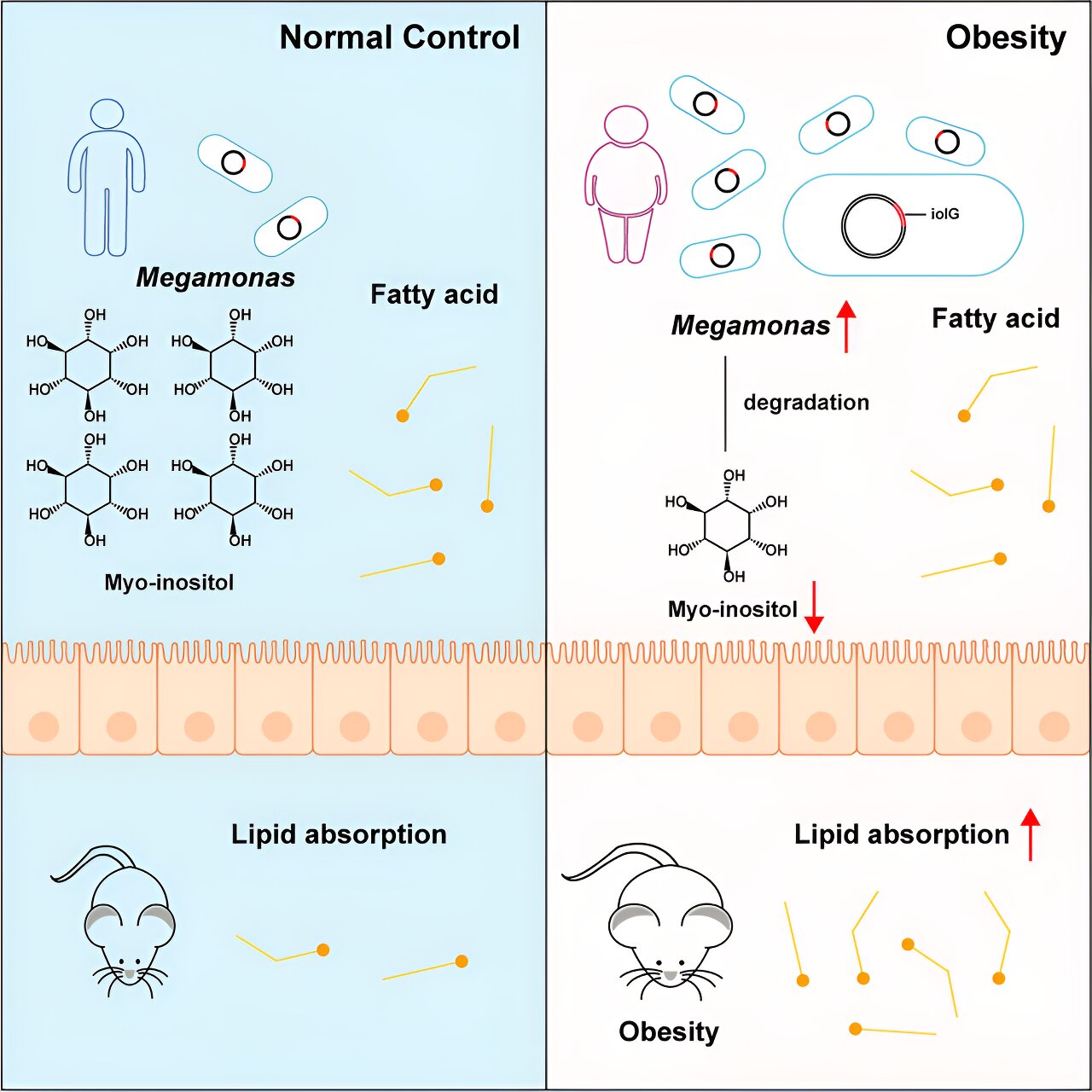 Research reveals gut bacterium Megamonas tied to obesity risk