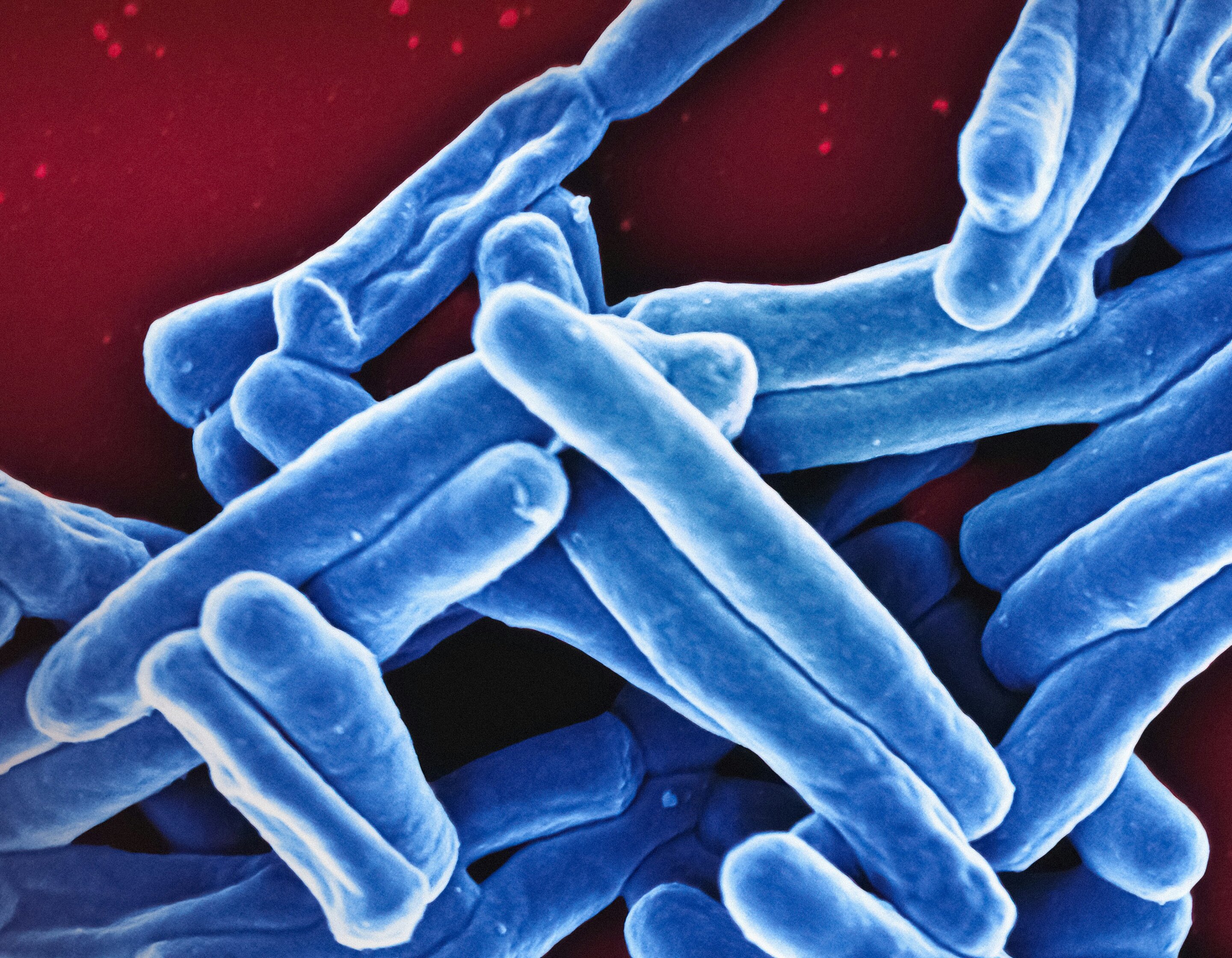 New findings on tuberculosis could change how we treat inflammatory disorders