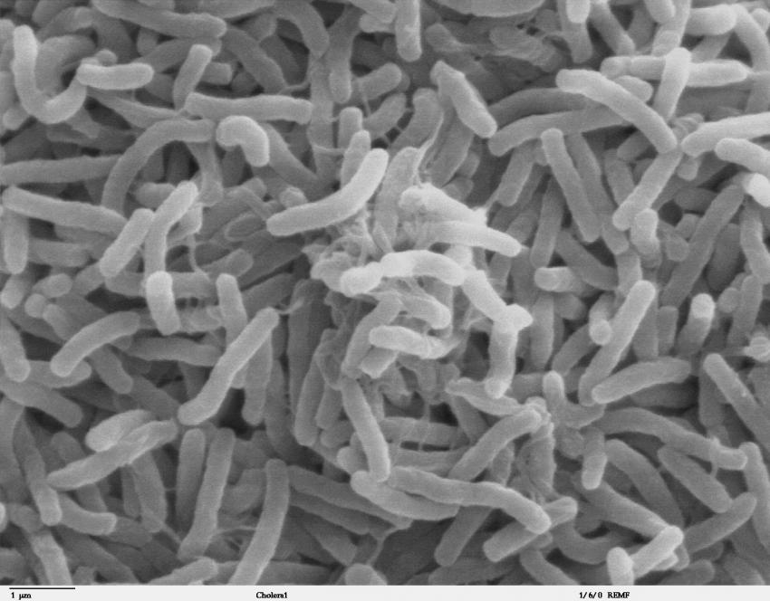 Experts discover the deadly genetics of cholera, which could be key to its prevention