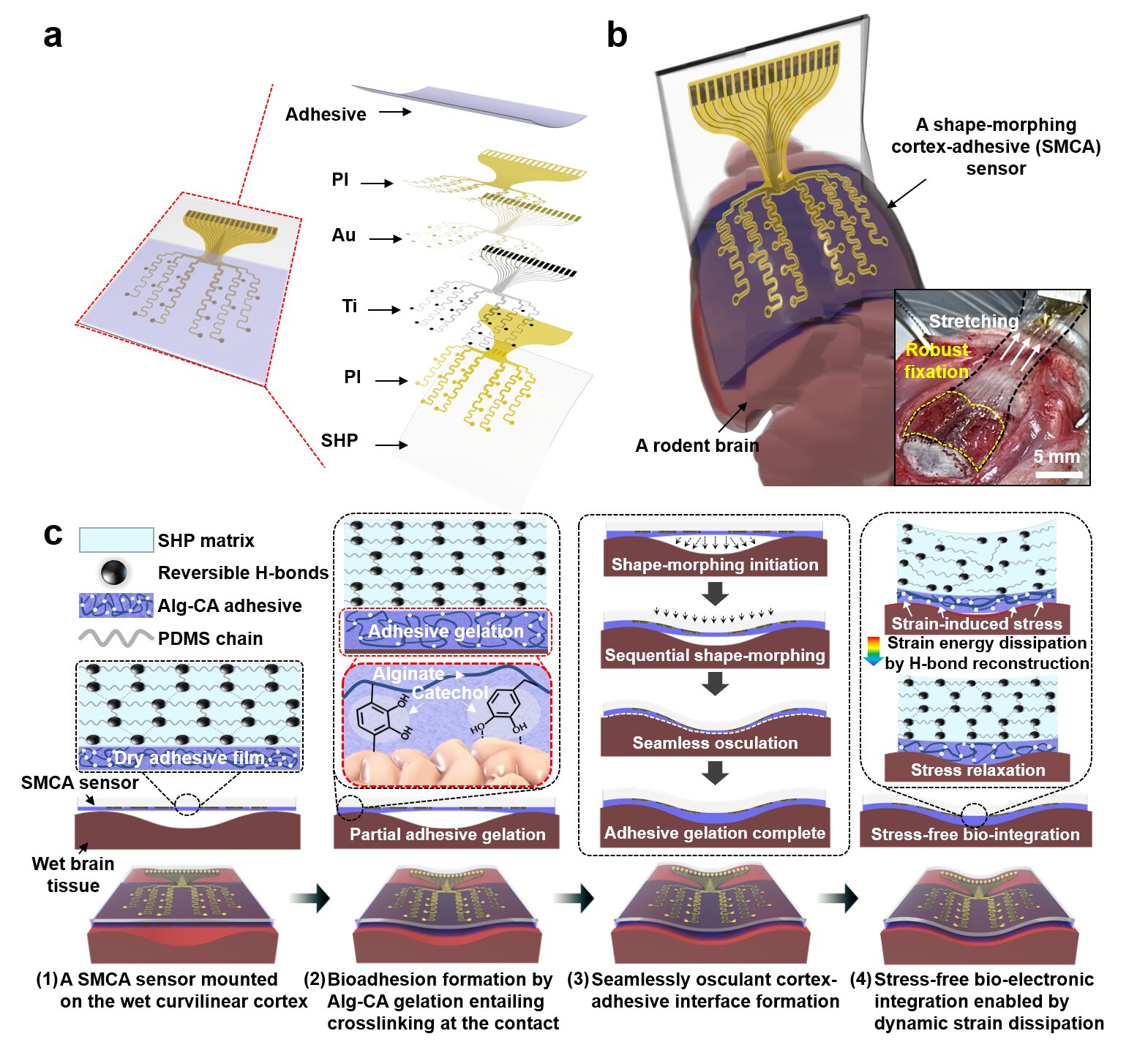 Adhesive cortical device enables artifact-free neuromodulation for closed-loop epilepsy treatment