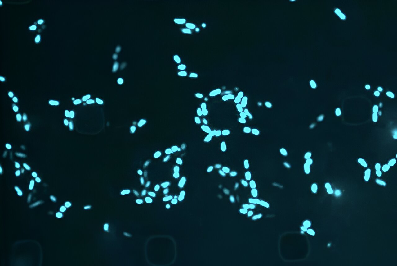 When an antibiotic fails: Scientists are using AI to target 'sleeper' bacteria