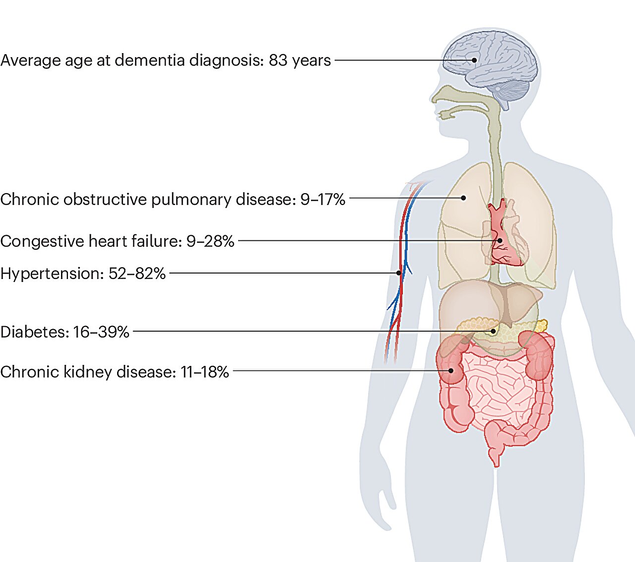 Preparing for widespread use of biomarkers to diagnose Alzheimer's disease