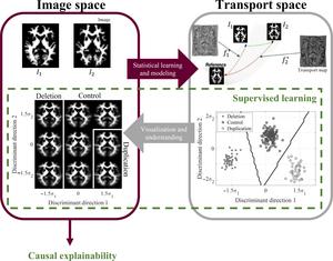 UVA research cracks the autism code, making the neurodivergent brain visible