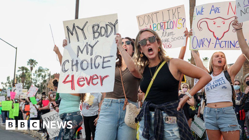 Arizona abortion ban: What you need to know