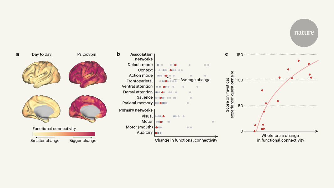 A psychedelic state arises from desynchronized brain activity