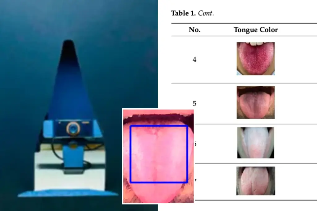 AI model 98% accurate in detecting diseases — just by looking at your tongue