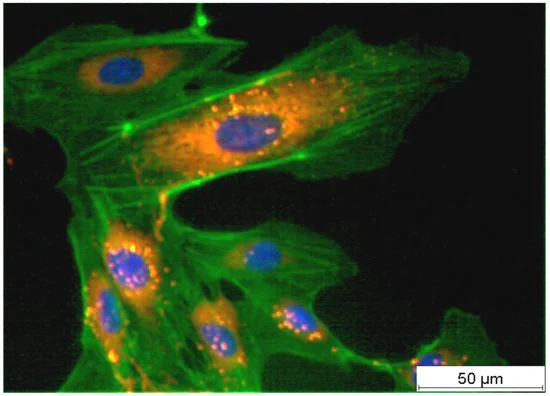 Breakthrough Polysaccharide from Spirulina Shows Promise as Antioxidant and Immune Booster in Multiple Industries