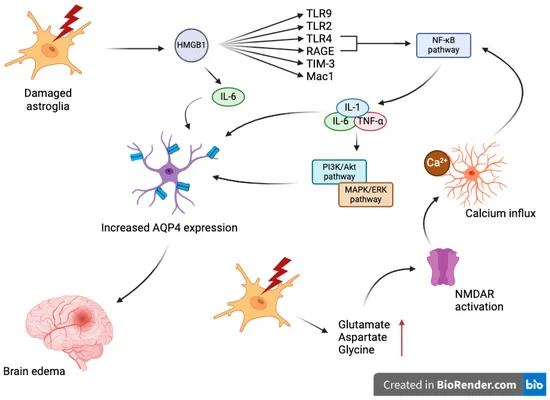 Breakthrough in Brain Injury Care: AQP2 Biomarker Shows Promise in Treating Chronic Subdural Hematoma