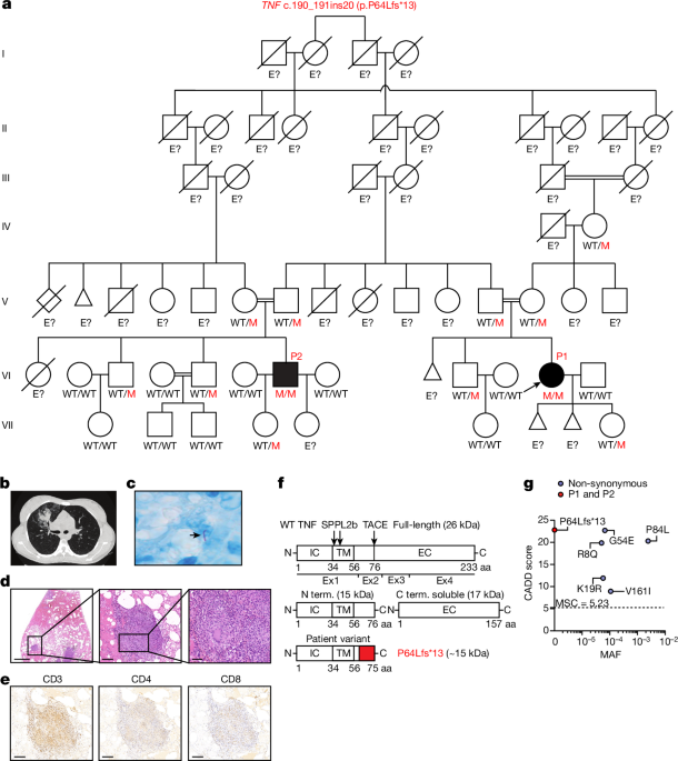 Study Unveils Genetic Link Between TNF Deficiency and Recurrent Tuberculosis