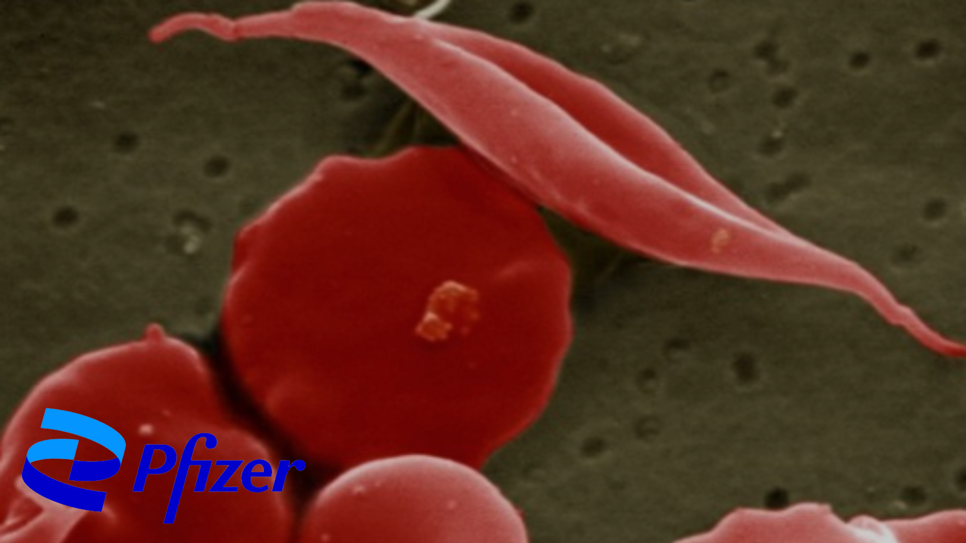 Pfizer Pulls Sickle Cell Drug Oxbryta Amid Fatal Safety Concerns, Shocking Medical Community